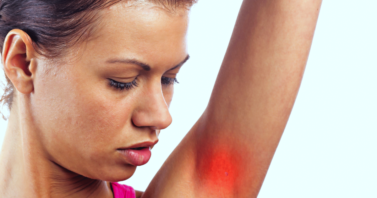 Skin Pain - Symptoms, Causes, Treatments