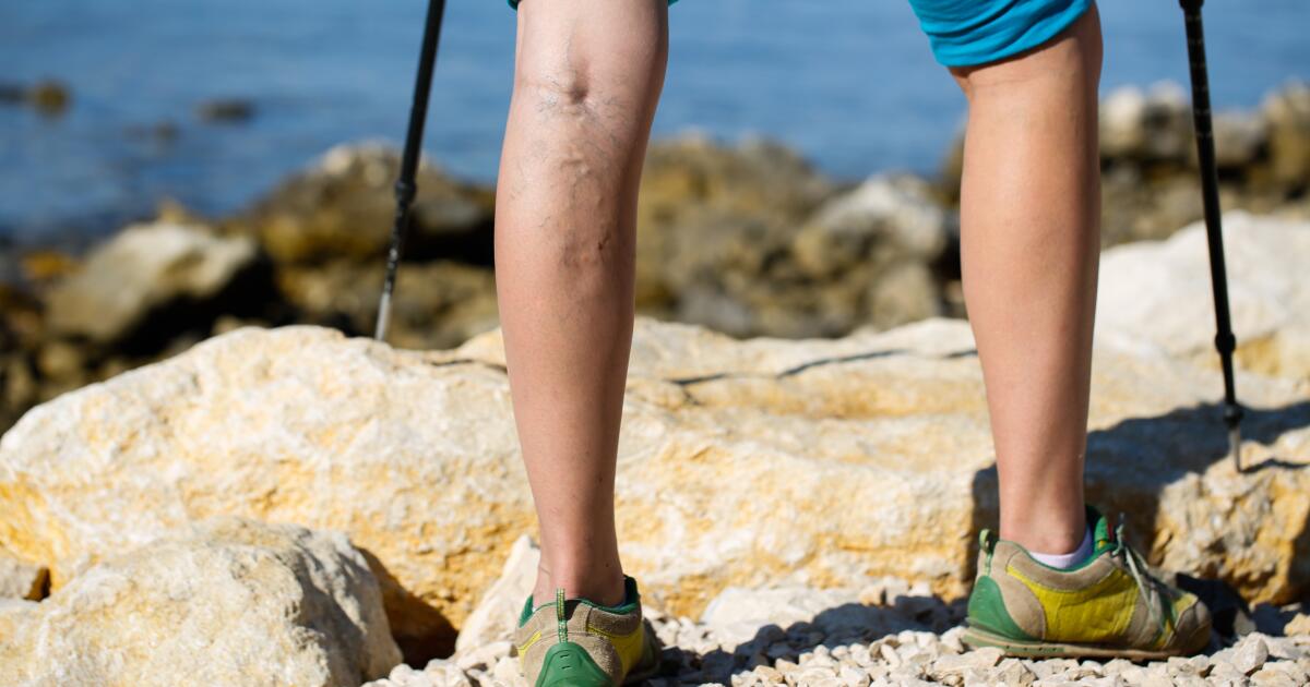 Behind Knee Swelling Symptoms, Causes, Treatments