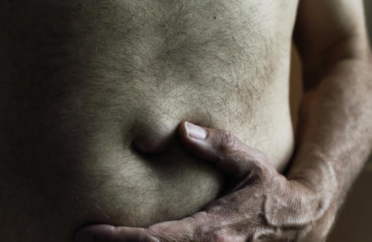 Close-up of Caucasian man holding stomach with umbilical hernia