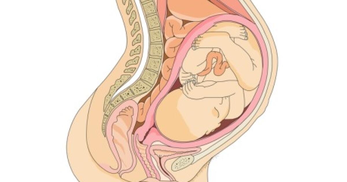 Artificial Rupture Of Membranes Amniotomy