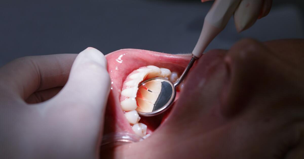Bleeding Gums