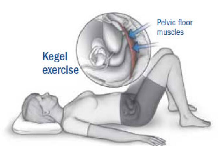 Pictures kegel exercise 7 Best