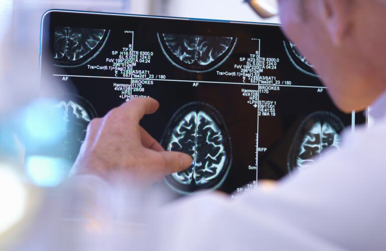 radiologist assessing CT brain scan