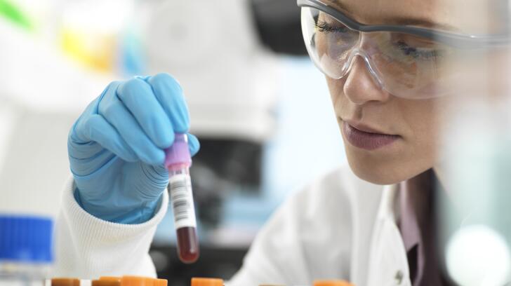 scientist or lab technician wearing safety glasses and gloves while holding test tube of blood sample