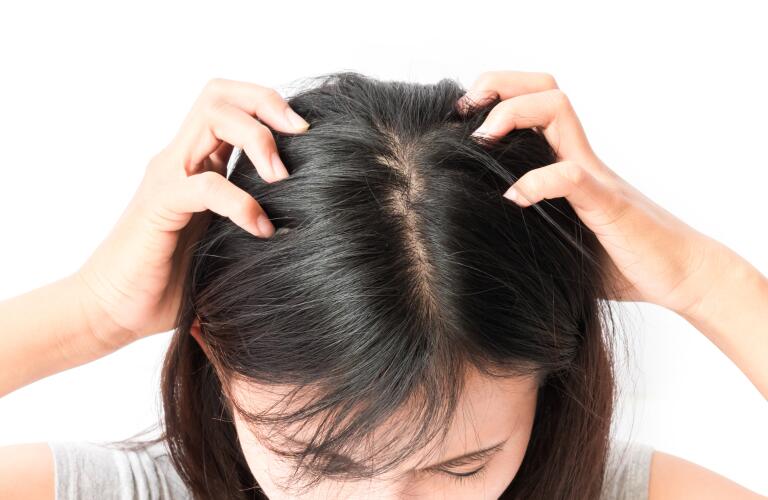 woman with dark hair itching scalp
