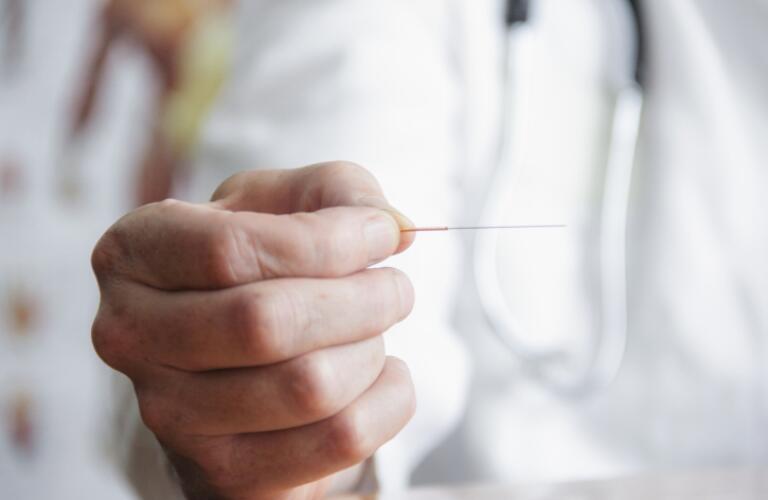 Doctor holding acupuncture needle