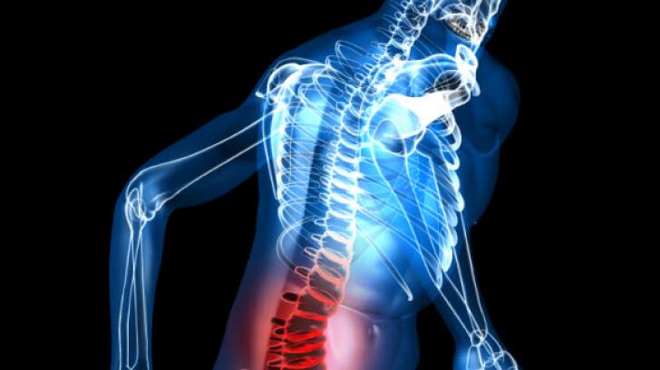 Degenerative Disc Disease