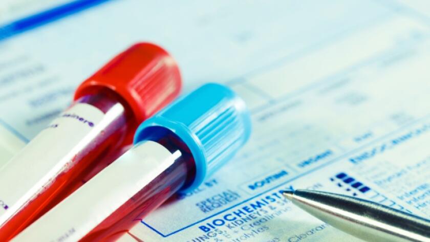 Blood test