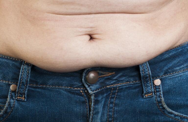 obese-man's-stomach