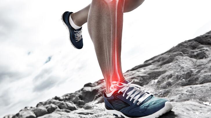 6 Things To Know About Shin Splints