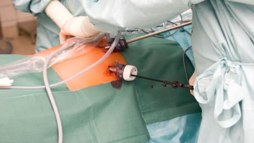 Laparoscopy