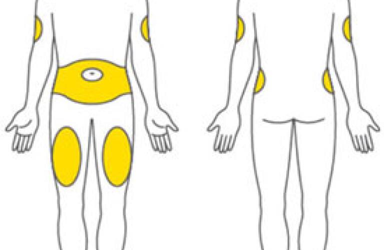 Trulicity Healthgrades (dulaglutide injection, solution)