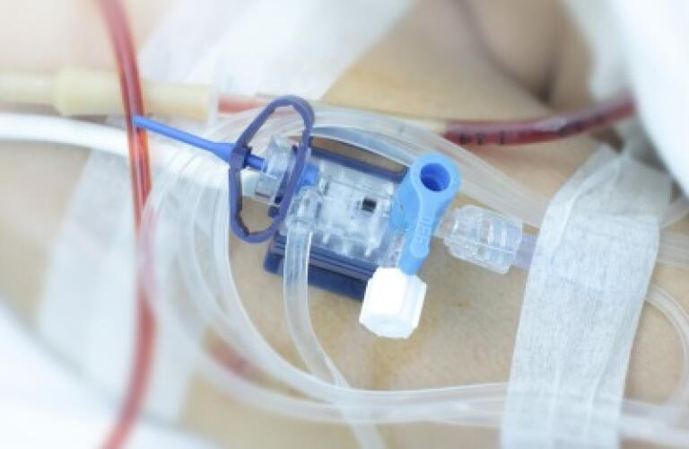 Arterial Line Insertion