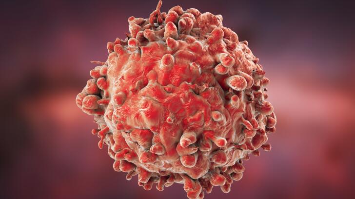 9 Things To Know About Radiation Therapy
