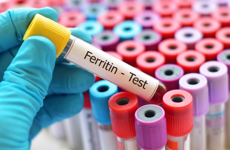 gloved hand holding test tube with blood sample for ferritin test, which is a measure of stored iron