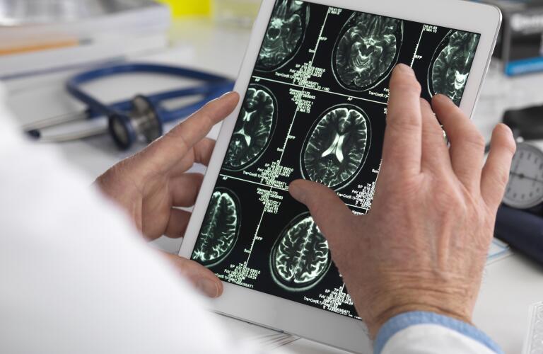 Close-up of doctor's hands looking at brain ct or mri scan on tablet