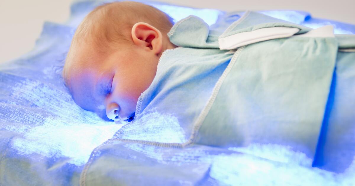 Jaundice Treatment Light Therapy, Exchange Transfusion & More