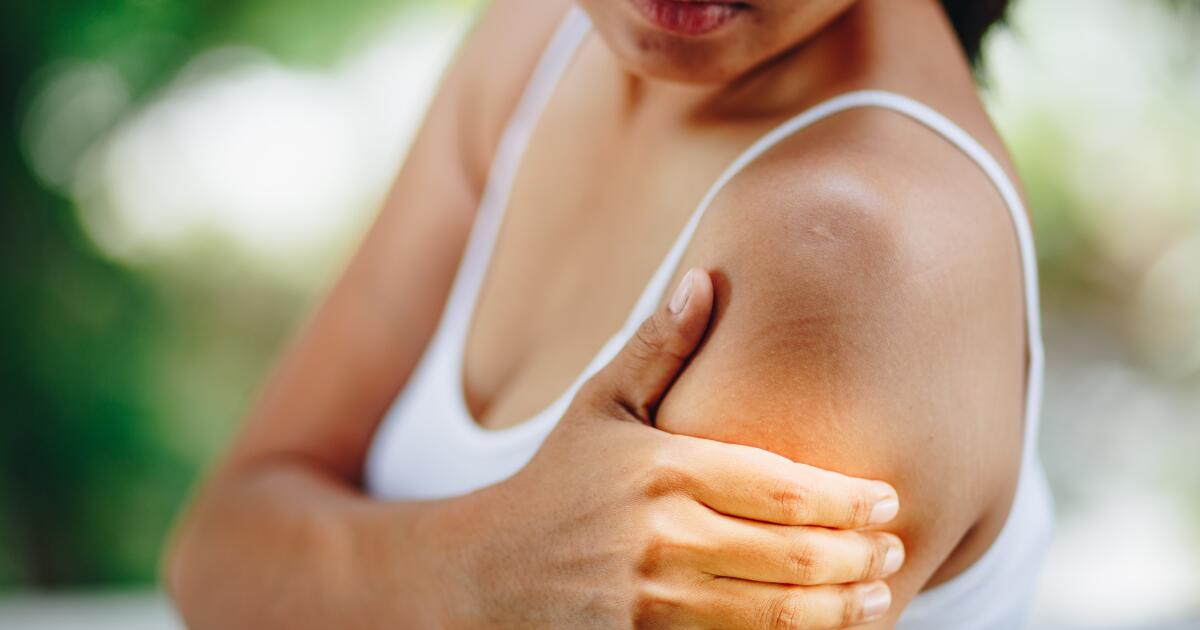 Treating Hives Hives Information Treating Hives Hives Information