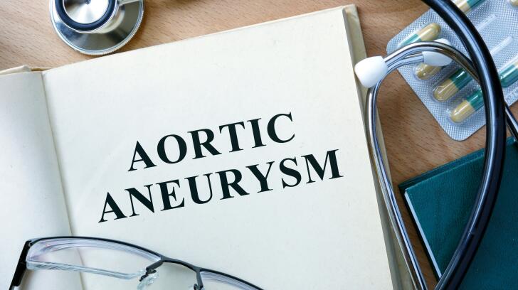 8 Things to Know About Aortic Aneurysms 8 Things to Know About Aortic Aneurysms