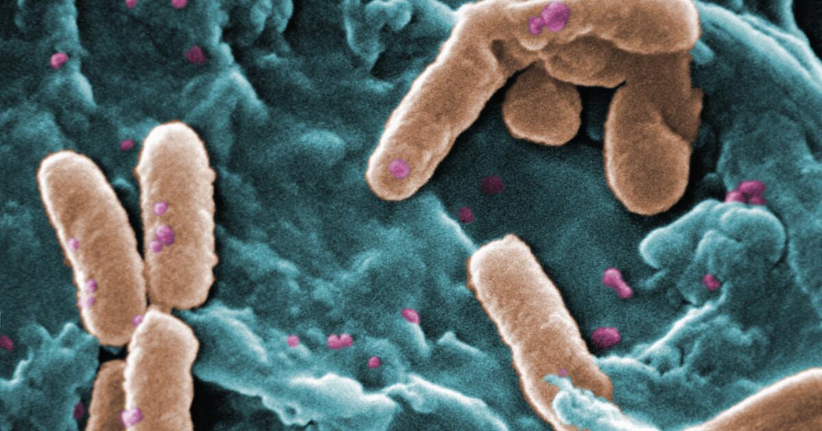 Pseudomonas Infection Symptoms & Treatment P. aeruginosa & P