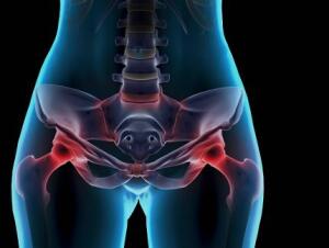 Image result for pelvic pain