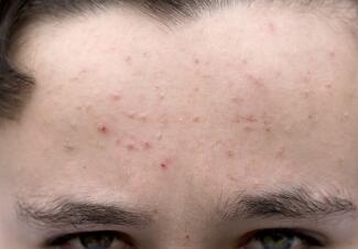 Common Skin Conditions At A Glance Healthgrades Com