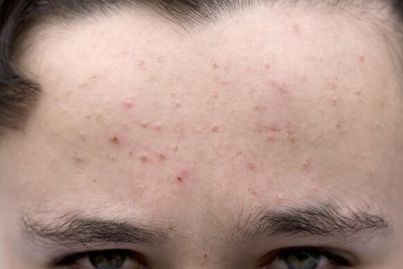 Common Skin Conditions at a Glance | Healthgrades.com