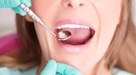 Fillings are a treatment for cavities due to tooth decay. But not all fillings are the...