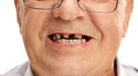 Replacing missing teeth can restore your appearance and confidence. Start here to learn...