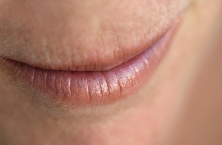 dry-mouth