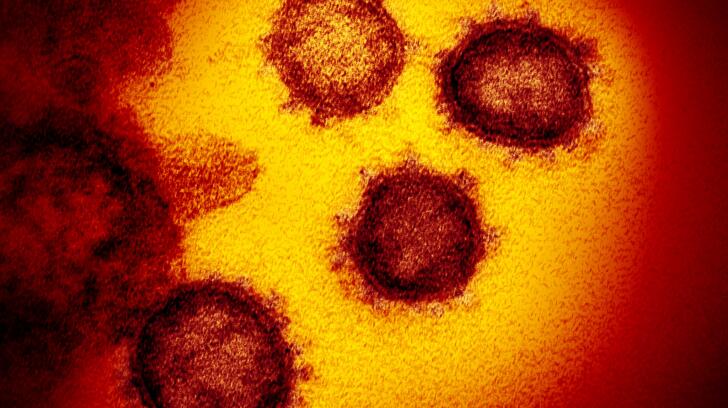Hình ảnh kính hiển vi điện tử truyền qua của SARS-CoV-2 — coronavirus gây ra COVID-19 — nổi lên từ bề mặt của các tế bào được nuôi cấy trong phòng thí nghiệm.  Nhà cung cấp hình ảnh: Viện Quốc gia về Dị ứng và Bệnh truyền nhiễm-Phòng thí nghiệm Rocky Mountain, NIH