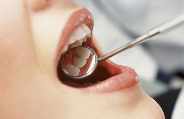 Close up of dentists angled mirror in womans mouth