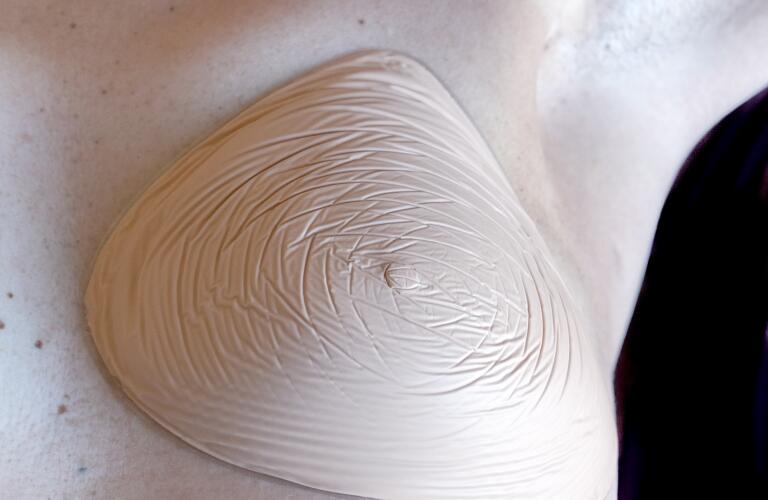 women with a prosthetic breast on the left side