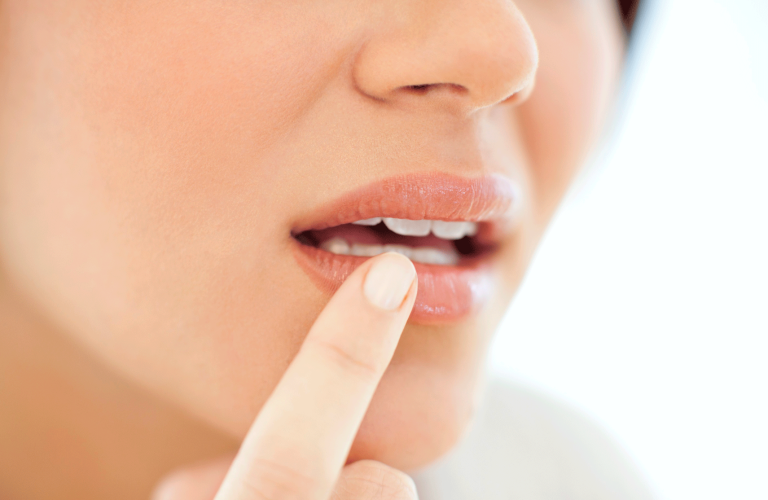 Cold Sores Frequently Asked Questions