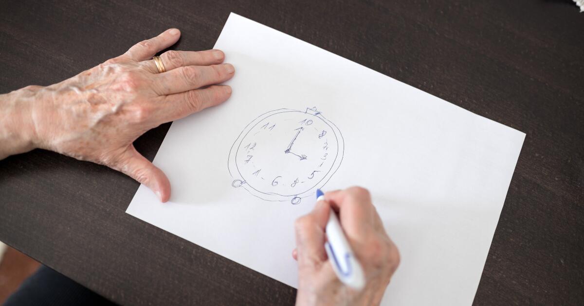 MoCa (Montreal Cognitive Assessment) Test for Dementia