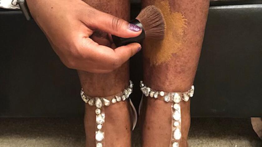 To Cover Up or Go Bare The Big Debate Behind Psoriasis and Body Makeup