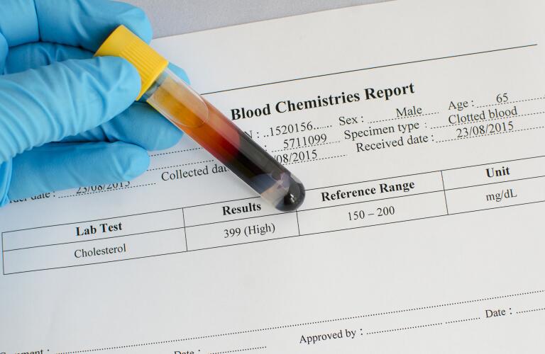 blood-vial-in-front-of-results-sheet