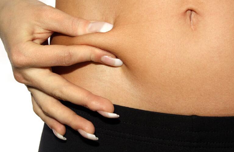 Liposuction