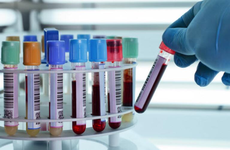 technician placing blood tubes in lab centrifuge, laboratory