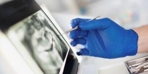 Dental X Ray Facts How Dentists Use Teeth X Rays