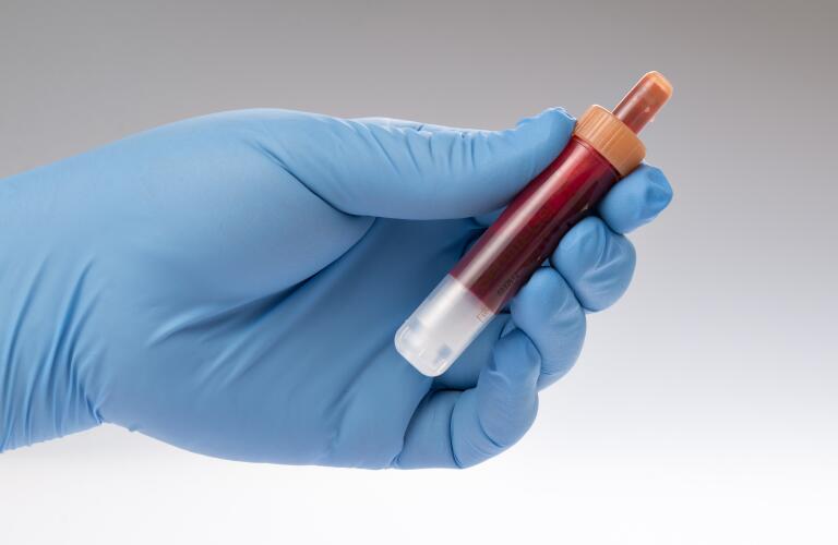 blood-vile-test-tube