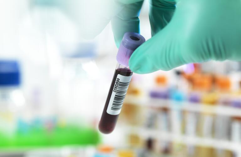 Unseen lab technician holding blood sample vial