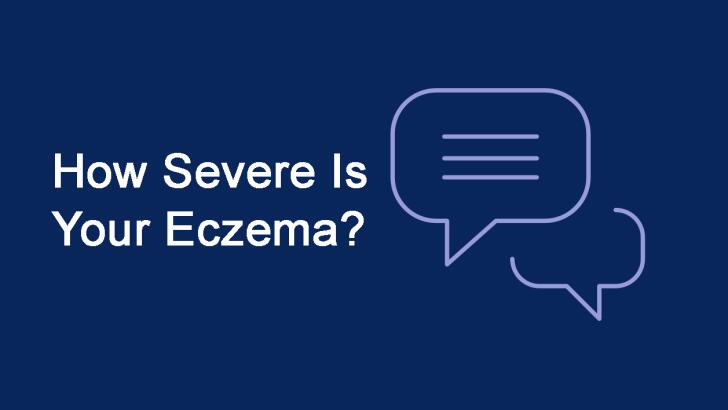 Finding Solutions For Eczema Finding Solutions For Eczema