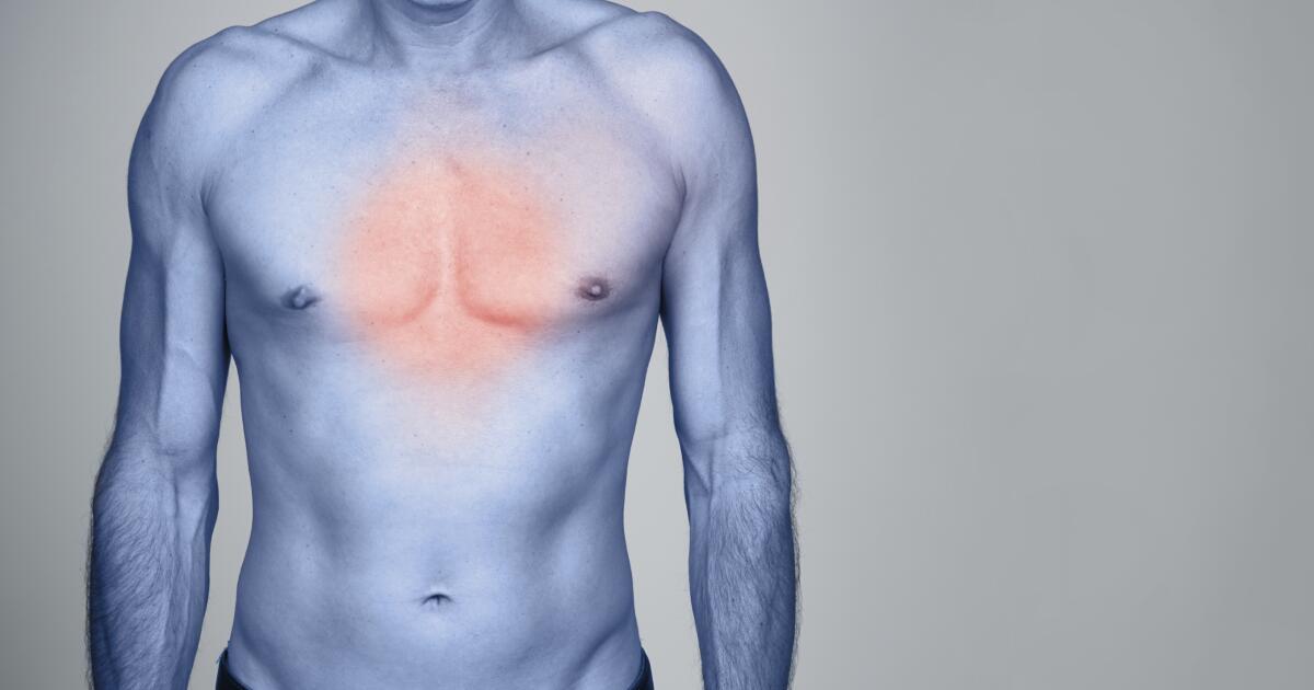 Chest Rash Symptoms Causes Treatments
