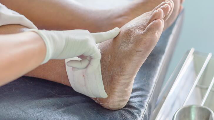 9 Tips For Coping With Gout Pain