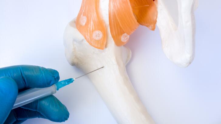 Bone Cancer 10 Things Doctors Want You To Know