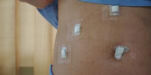 Most Painful Surgeries And How To Prepare For The Recovery