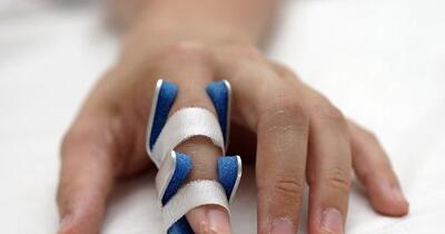 Broken Finger Symptoms Causes Treatments Healthgrades Com